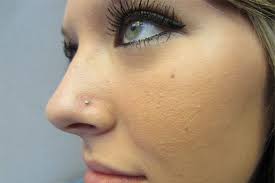 Girls With Nose Piercings And Their Struggles Ayur Health Tips Nose Piercing Care Nose Piercing Tips Girls With Nose Piercing