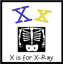 Letter X Free Letter Pack Letter A Crafts Free Lettering Letter X Crafts