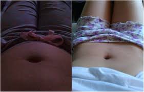 Preocupada Sintomas Sumiram E Barriga Secou Junho De 2019 Babycenter