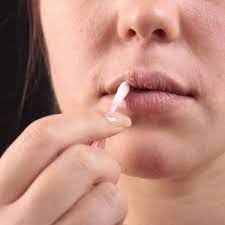Die bläschen am mund sorgen für distanz. Wie Gefahrlich Ist Herpes Und Was Kann Ich Dagegen Tun Gesundheit