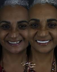 Dra. Fernanda Landim Cruz (@drafernandalandim) • Instagram फोटोहरू र  भिडियोहरू