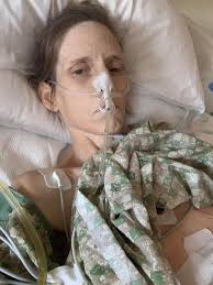 Dealing with Ostomy Bag Issues and Crohn's Disease