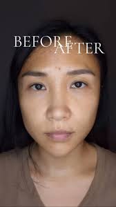 Consider this your eyelid couture moment. Filler placed so precise it  lifts, smooths, and refreshes without a trace. No heaviness, no creasing,  just eyes that look awake, elegant, and naturally ...