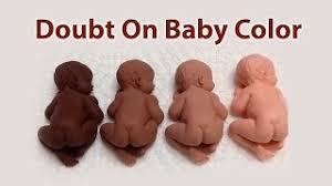 Check spelling or type a new query. Doubt On Baby S Skin Tone Kkma Youtube