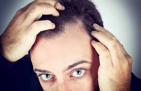 You inherit hair loss from your mother. Why Is Hair Loss More Common In Men Than Women