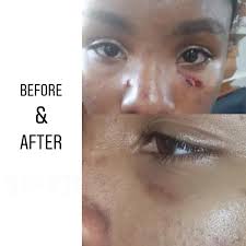 Natural Skin Healers Barbados