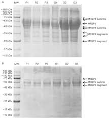 You can get dark ether cane by killing scorn enemies out in the world. Royal Jelly Lipophilic Fraction Induces Antiproliferative Effects On Sh Sy5y Human Neuroblastoma Cells