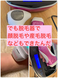 顔脱毛は脱毛器でできる 脱毛器 脱毛 顔の脱毛
