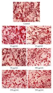 Image result for Dolichos angustifolius