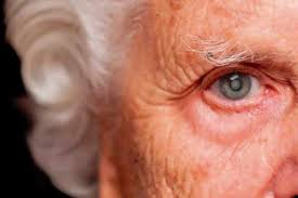 Maybe you would like to learn more about one of these? Cataratas Centro Medico De La Vision Tienes Mala Vision