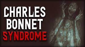 Charles Bonnet Syndrome Scary Stories Creepypasta Youtube