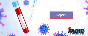 Sepsis is the consequence of widespread inflammation (swelling) in the body. Sepsis Updates In The Management Of Sepsis And Septic Shock Fadic