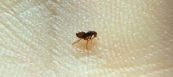 Rub the baking soda into your hair and apply the shower cap (wait 15 minutes). Can Fleas Lay Eggs On Human Hair Abc Blog
