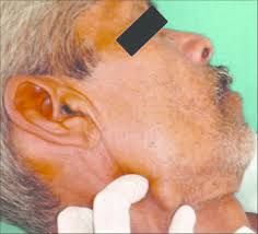 Image result for Submandibular Exam