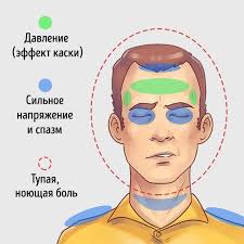 Тест Почему у меня часто болит голова? В чем причина?