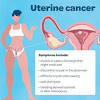 The top is the fundus, the middle is the corpus, and bottom is the cervix; 1