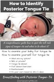 Some, however, have a posterior tongue tie, at the back of the mouth, which is much harder to spot.this is often called a 'hidden tongue tie'. 54 Tongue Ties Lip Ties Breastfeeding Speech Ideas In 2021 Tongue Tie Breastfeeding Tongue