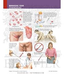 Image result for chancroid