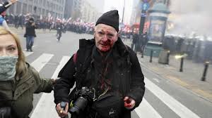Policjant z raciborza został śmiertelnie postrzelony podczas interwencji. Fotoreporter Postrzelony Na Marszu Niepodleglosci Policja Nieszczesliwy Wypadek Polsat News