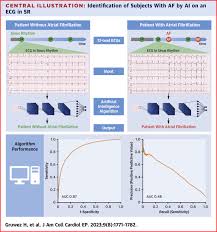 Image result for Electrocardiogram Validity