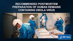 The issues brought up are almost always completely ignored by management and they continue to make. Recommended Postmortem Preparation Of Human Remains Containing Ebola Virus Youtube