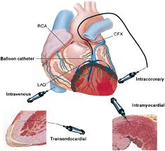 Animal cell therapies, inc., san diego, california. Stem Cell Therapy In Perspective Circulation