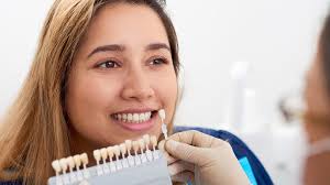 After determining that the patient is an ideal candidate for veneers, we will take an impression of the teeth. Dental Veneers Cost Procedure And Results