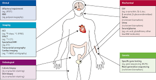 Parkinson S Disease The Lancet