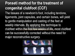 Check spelling or type a new query. Ponseti Method For The Treatment Of Congenital Clubfoot Ccf Ppt Download