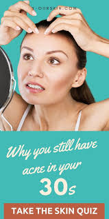 Pin By Y Our Skin Care On Skin Care For Acne Skin Quiz Skin Skin Care