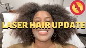 What makes laser hair removal problematic for dark skin is when the laser targets the. Quick Laser Hair Removal Update Chin Jaw Upper Lip Laser Hair Removal On Dark Skin Youtube
