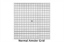 amsler grid test free amsler grid pdf specialty eye institute