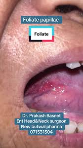 Image result for Filiform Papillae