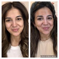 Lazy skincare routine results in glowing skin