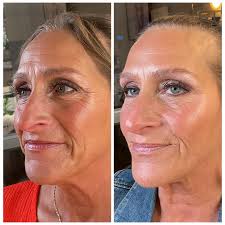 This is my dear, amazingly beautiful friend Julie. This is her results  after 2 months of using our skin care products. You can see the redness is  disappearing, her age spots have