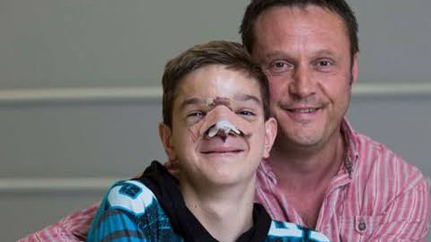 Soldier spearheads effort to reconstruct face of boy with facial cleft -  DongA Science