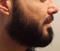 La restauration de la barbe a connu une augmentation significative dans le monde entier au cours des pour plus de détails demandez votre devis greffe barbe gratuit et détaillé et profiter d'un prix greffe de barbe tunisie tout compris. Les Greffes De Poils Et De Barbe Les Greffes Medecin Esthetique Marseille Dr Martin Peridier