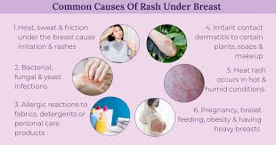 Image result for heat rash under breasts