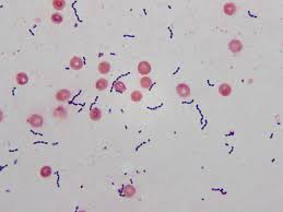 Image result for CSF Gram Stain