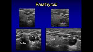 Maybe you would like to learn more about one of these? Neck Ultrasonography Imagenologia