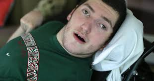 Teen's life 5 years after lightning strike