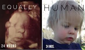 Harmony Hart (@Harmonyfreehart)