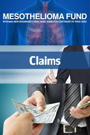 Mesothelioma Xenograft Mesothelioma With Images Mesothelioma Mesothelioma Awareness Immunotherapy