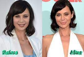 Catherine Bell Plastic Surgery Rumors Any Truth Behind It Catherine Bell Celebrity Plastic Surgery Plastic Surgery