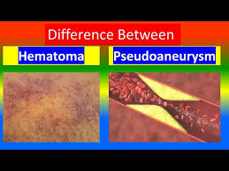 Image result for Pseudoeriosema