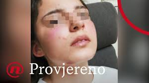 BIVŠI HRVATSKI SPECIJALAC BRUTALNO PREMLATIO ĆERKU (14): Devojčica preko  balkona pobegla kod komšije, ali je pomahnitali otac izvukao napolje i  nastavio da je tuče, njenom glavom otkinuo letvu sa ograde! (VIDEO)