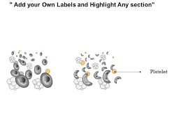 0914 Sickle Cell Anemia Medical Images For Powerpoint