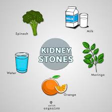 If You Re Trying To Avoid Kidney Stones Here Are Some Of The Food Recommendations To Include In Your D Organic Green Tea Health And Nutrition Dehydrated Fruit