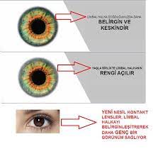 gozler yaslaninca yasla birlikte goz aki ile renkli kisim arasindaki bolum olan limbal halka siliklesiyor yeni nesil renkli kon gozler gencler yastiklar