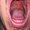 Coxsackie virus a16 cox a16 boleh menyebabkan penyakit; Https Encrypted Tbn0 Gstatic Com Images Q Tbn And9gctnigsi8uxtwmvlfxulhnfjwcfi9lh5onuuoadthzj Aizxwgmd Usqp Cau